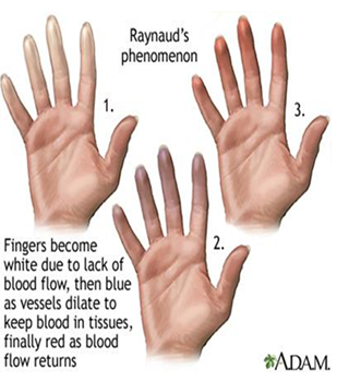 fig 2 the color of the finger changes